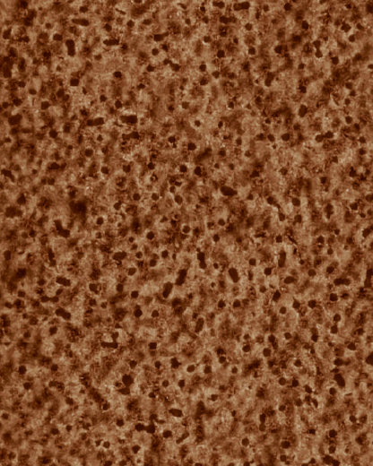 The Dewy Day Recarga